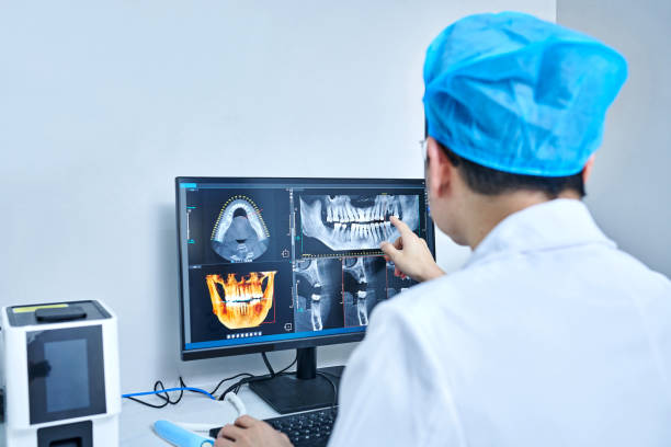 Best Teeth Whitening  in Severance, CO